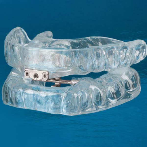 An oral sleep apnea device