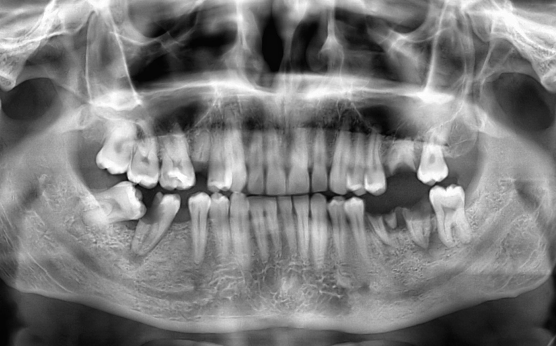 Image of dental x-ray